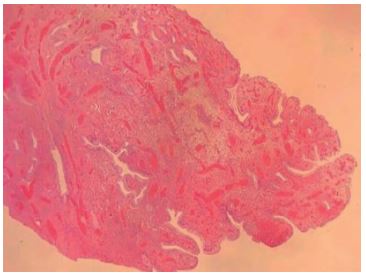 histología del endocérvix